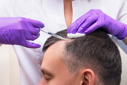 Plasma Therapy for Hair Growth