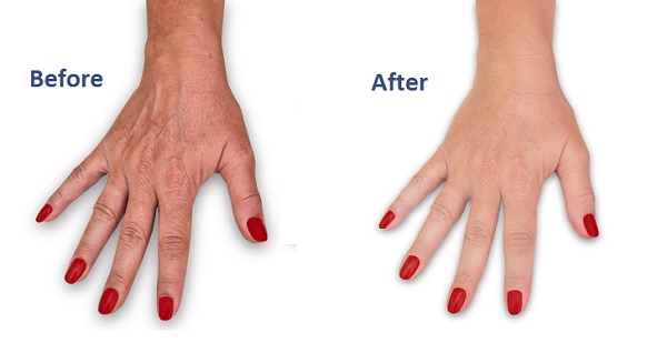 Best dermatologist near me